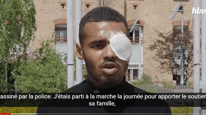 « J'ai perdu mon œil » : Virgil, 24 ans, éborgné par un tir de LBD lors de la marche pour Nahel