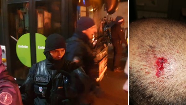 Violente répression au dépôt RATP de Pavillons-sous-Bois : un gréviste le crâne ouvert