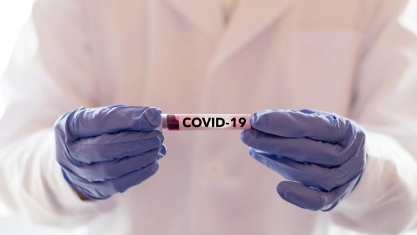 Coronavirus. 300€ pour un test de dépistage dans des hôpitaux privés espagnols